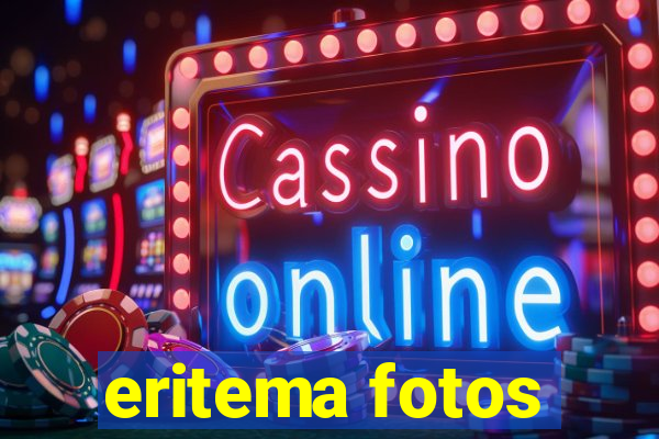 eritema fotos